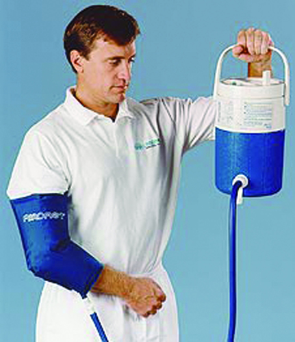 CRYO Systems & Cuffs Elbow Adult Cuff & Cooler * System features simultaneous cold and compression to minimize swelling and pain * Insulated jug holds up to 4 liters of ice *