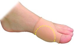 Bunion Bedder,Shield, Regulator Small - Medium, 1/Pk * 3mm soft flexible foot pad for protecting bunions by absorbing shock and shear forces, designed to fit comfortably in dress shoes * Soft stretch-fabric cover comfortably
positions gel pad over painful bunions (hallux joint) * Uncovered version allows mineral oil gel to soften and comfort painful and sensitive bunions (hallux joint) through direct contact with skin * Secures comfortably over the big toe and around the foot to prevent sliding * Washable and reusable *