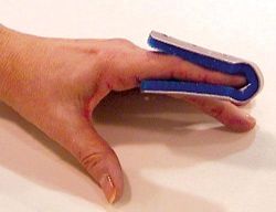 Finger Splints BULK - PK/6 (NON-RETAIL) * Small 1