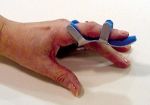 Toad Finger Splint Large Bulk PK/6 Non-Retail